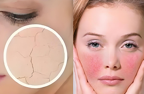 角質(zhì)層變薄還能恢復(fù)嗎？角質(zhì)層變薄怎么恢復(fù)？